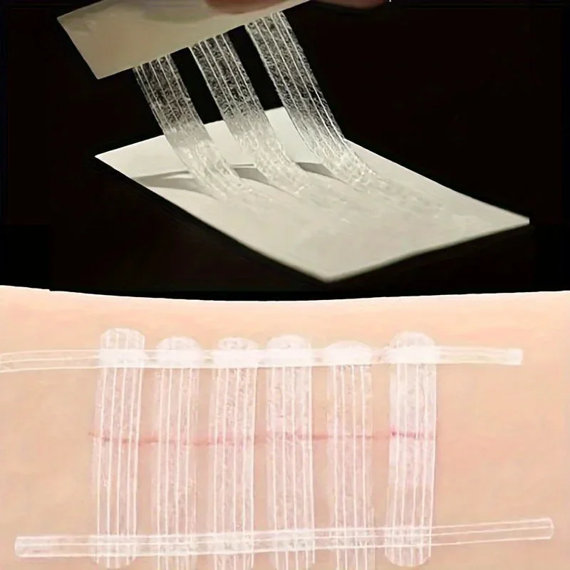 5 Strips Wound Skin Closure St - огляд і ціна Medical Label