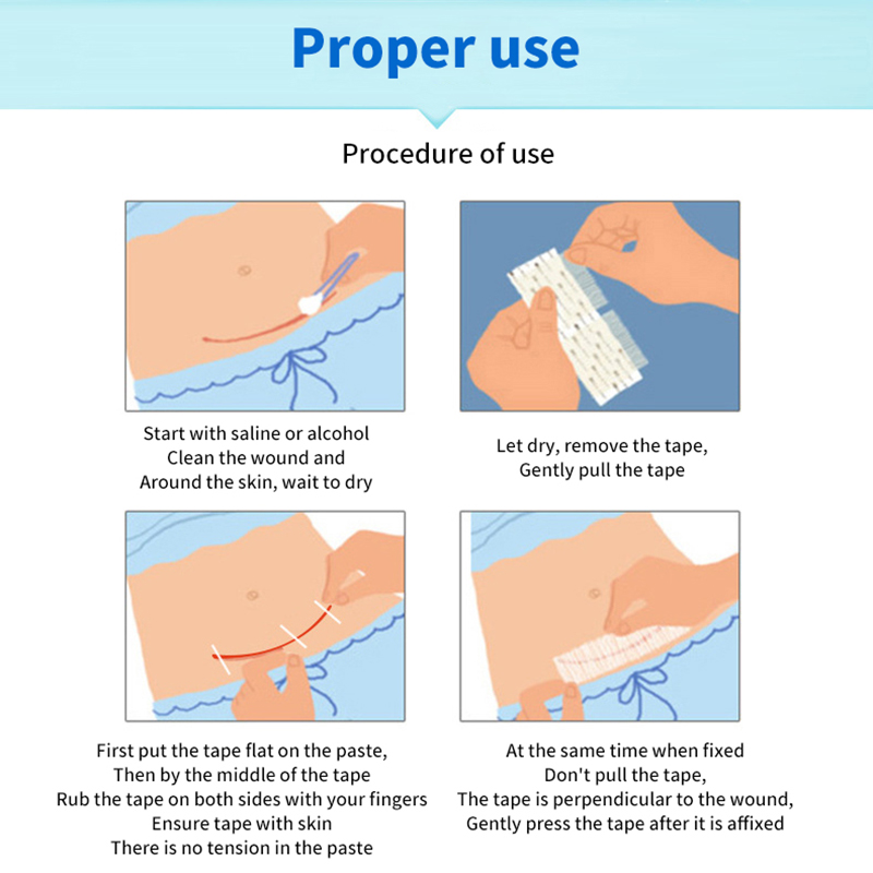 5 Strips Wound Skin Closure St - огляд і ціна Medical Label